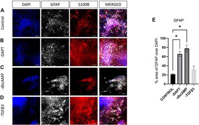 TGFβ3, dibutyryl cAMP and a notch inhibitor modulate phenotype late in stem cell-derived dopaminergic neuron maturation